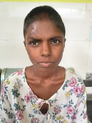 २० वर्षीय राधा मानव मानवसेवा आश्रम सर्लाहीकाे संरक्षणमा